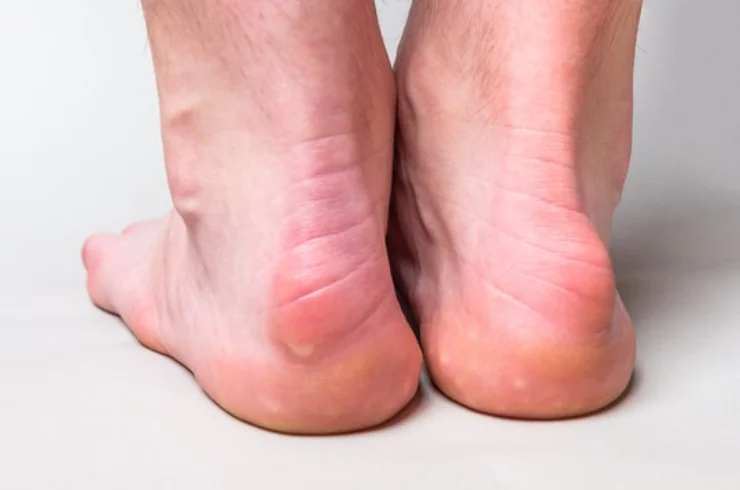 Deformity Correction