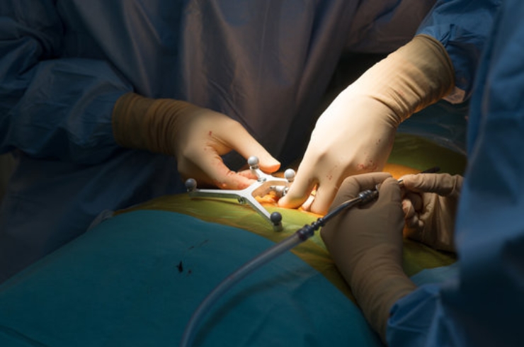 Spine Surgery------15